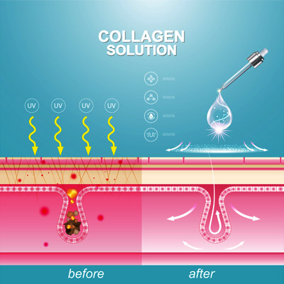 diagram of how collagen helps skin look younger
